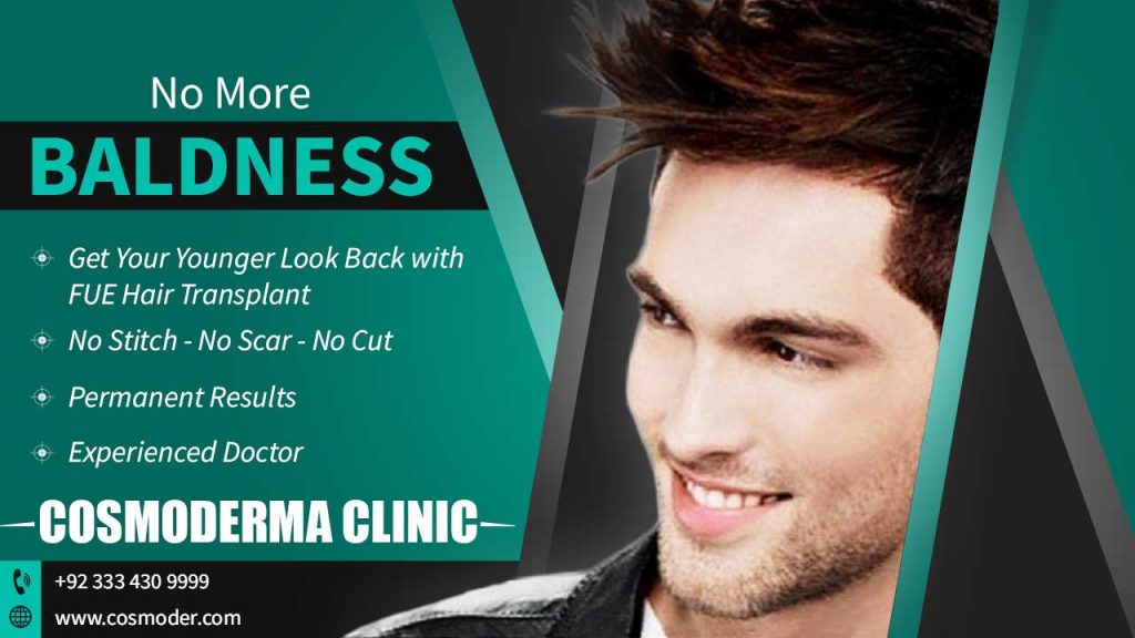 Baldness treatment clinic in Lahore