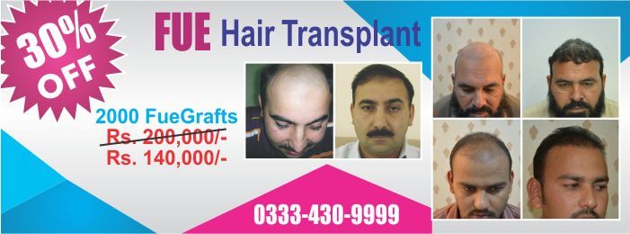 Fue hair transplant cost packages Lahore Pakistan 