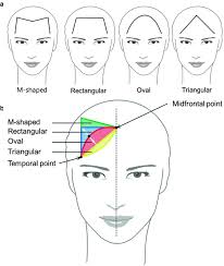 Female hairline types