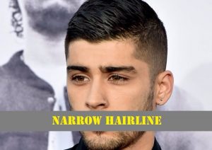 Narrow-or-Low-Hairline