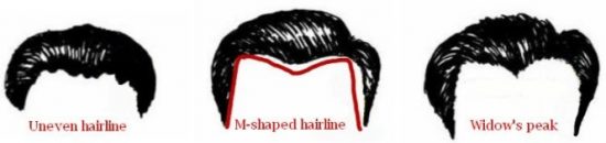 hairline-types
