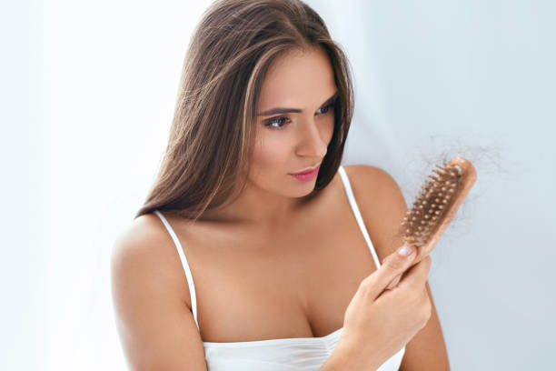 Female hair fall treatments