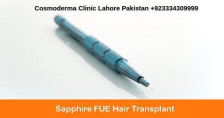 Sapphire fue hair transplant Lahore Pakistan