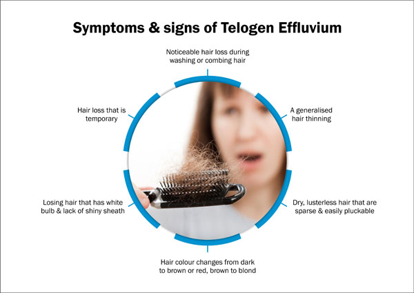 Sign symptoms telogen effluvium