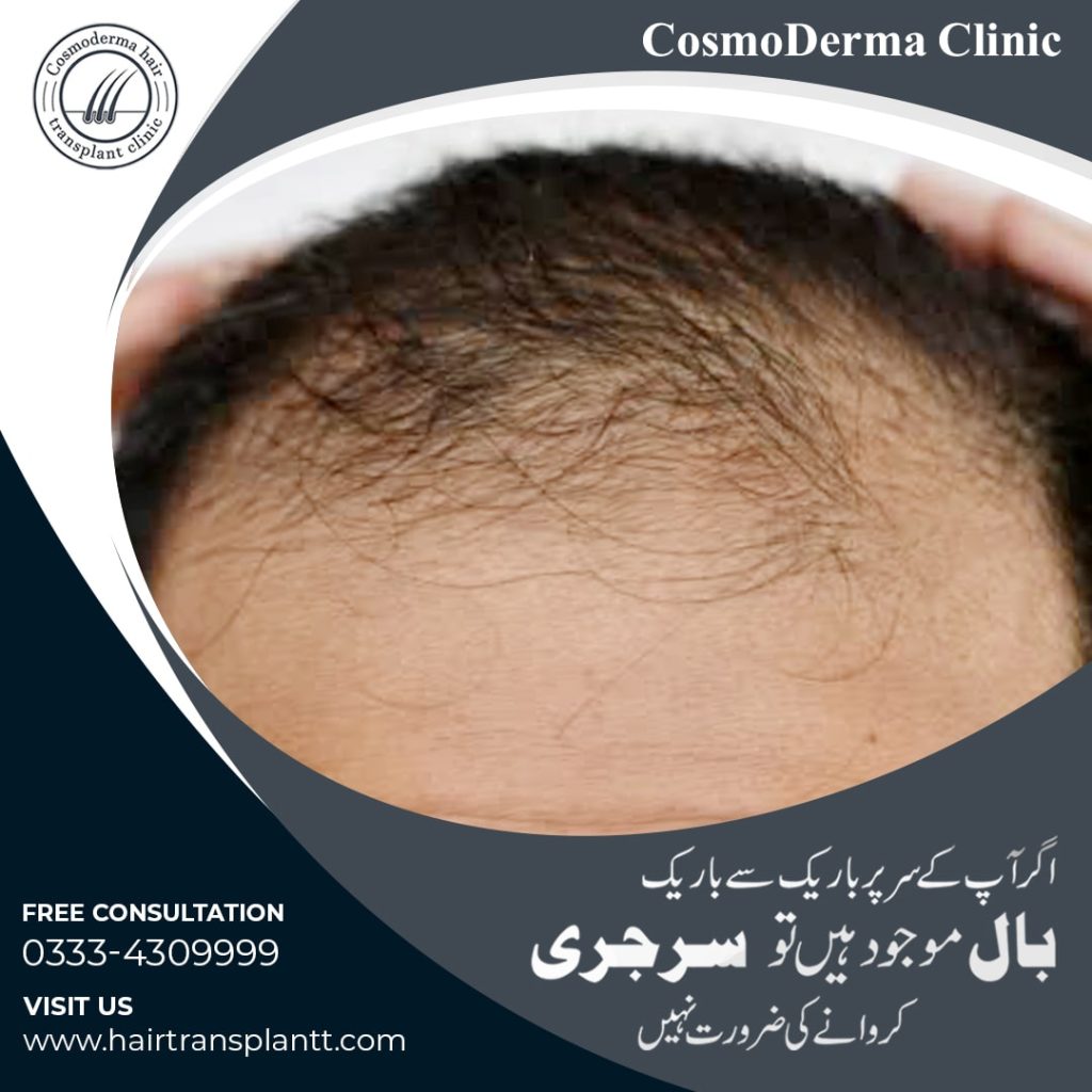 Best hair fall specialist Lahore